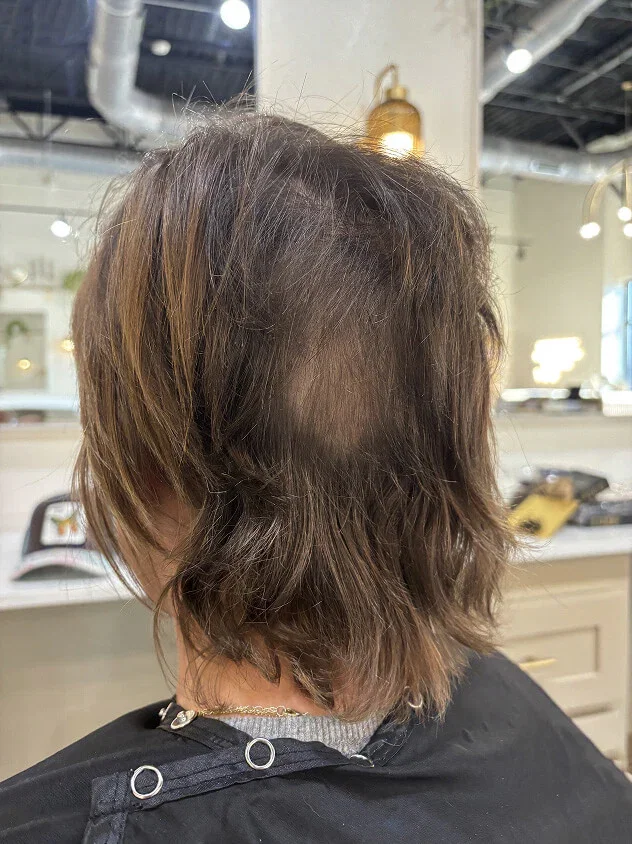 K-tip installation detail